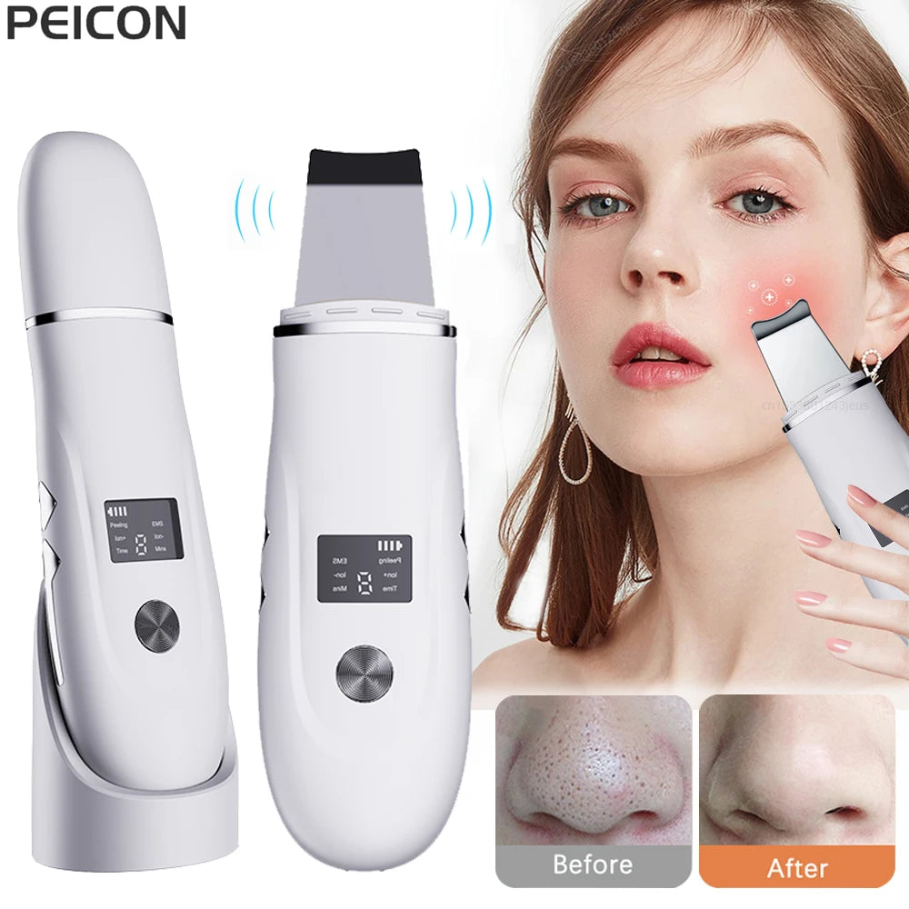 Ultrasonic Face Scrubber Facial Peeling Skin Scrubber Deep Facial Cleaning Spatula