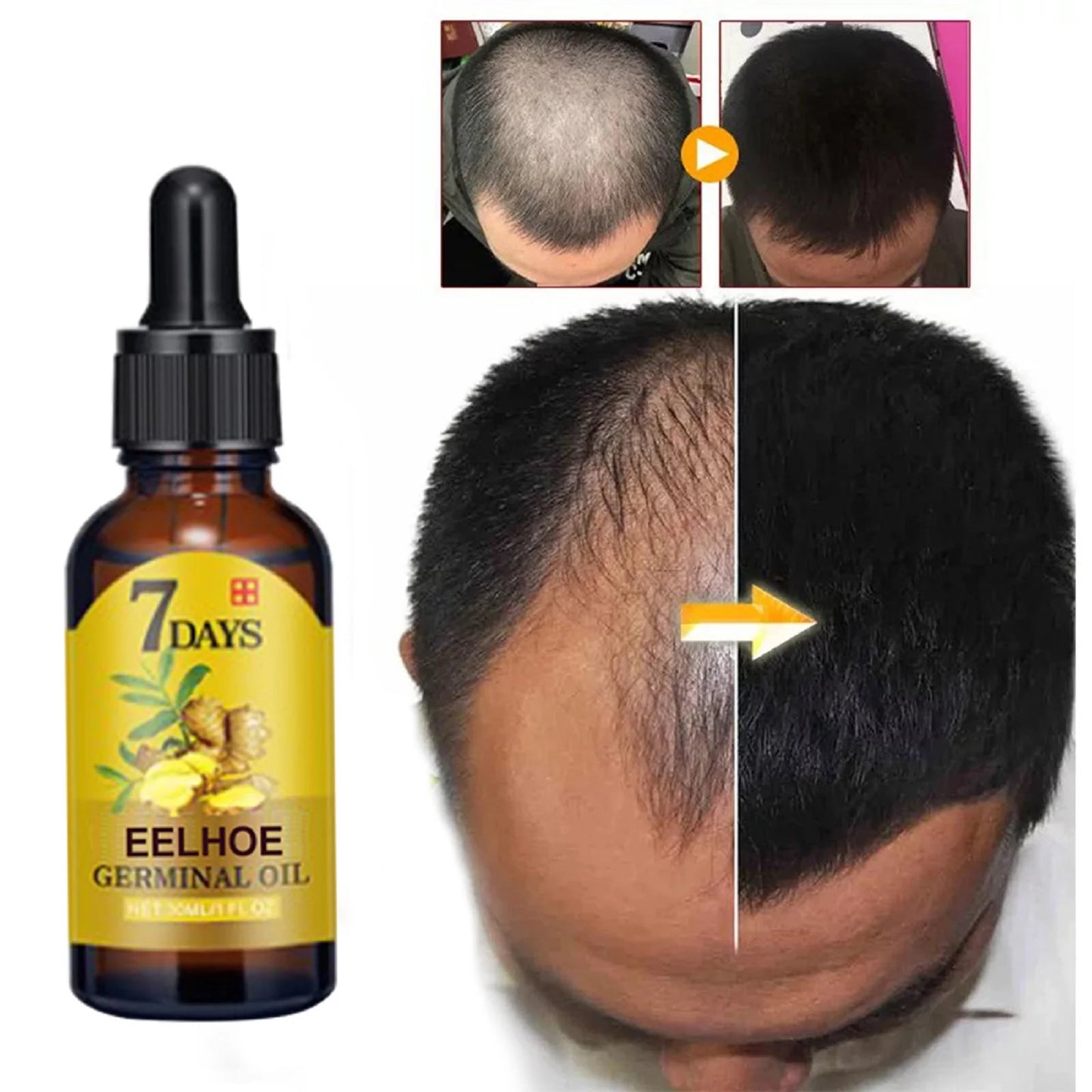 Ginger Hair Care Liquid Prevent Hair Loss Nourish