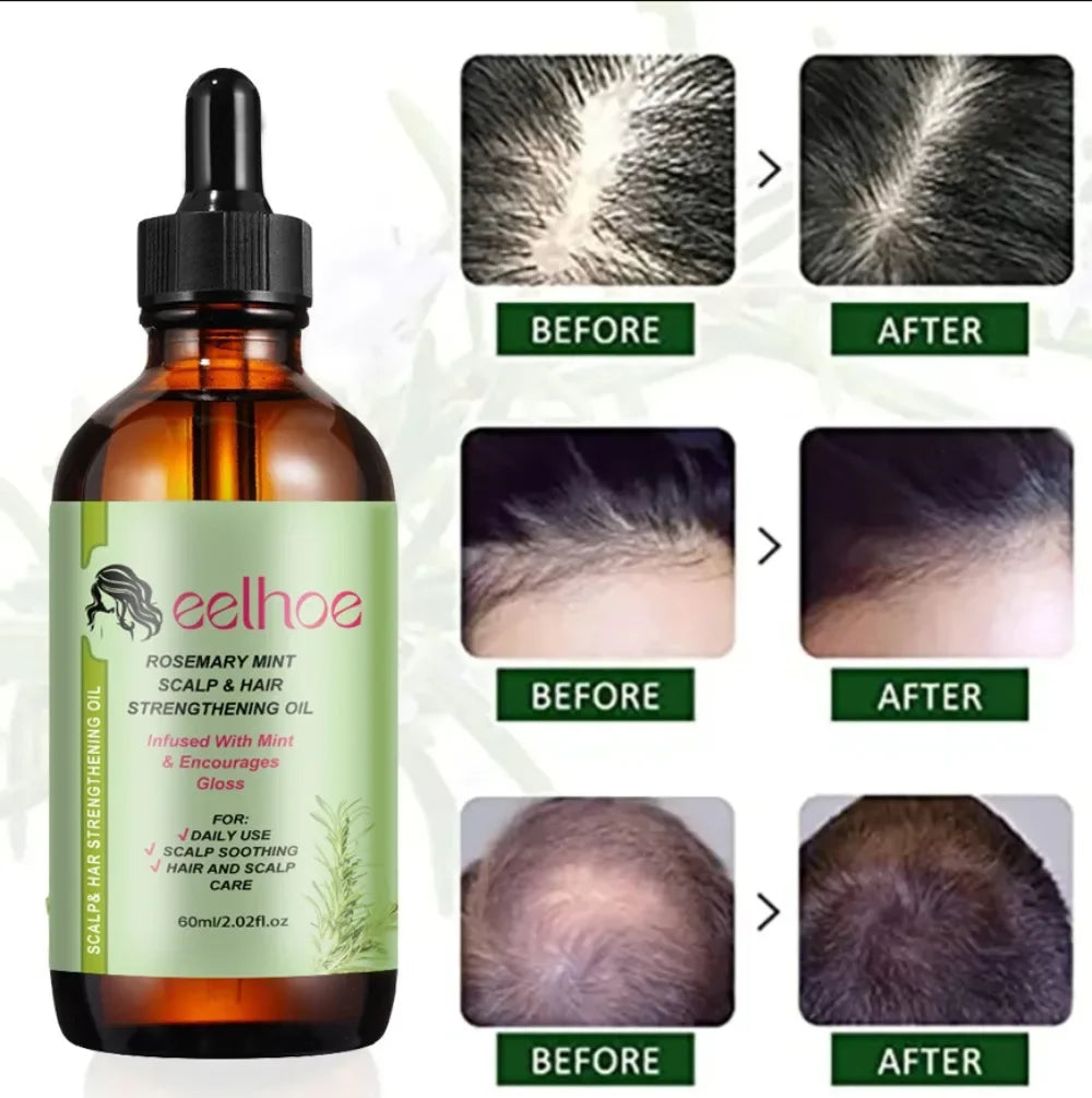 Hair Growth Essential Oil Rosemary Mint Hair Strengthening Oil