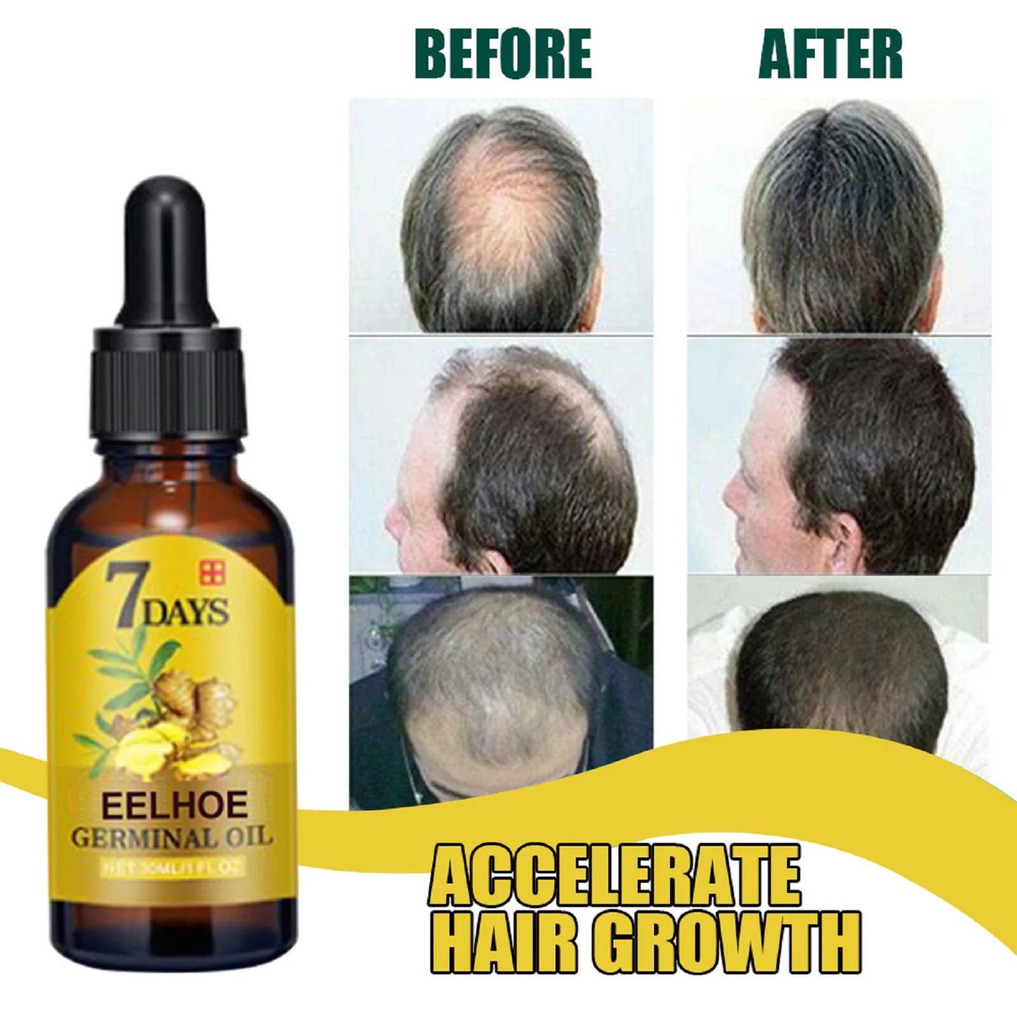 Ginger Hair Care Liquid Prevent Hair Loss Nourish